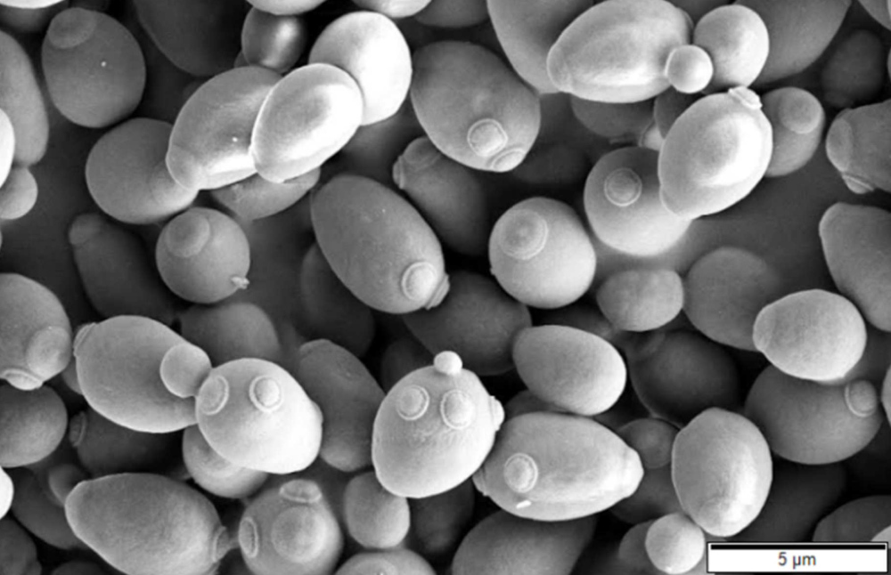 Saccharomyces cerevisiae, up close and personal. Image by Mogana Das Murtey and Patchamuthu Ramasamy, CC BY 3.0, via Wikimedia.
